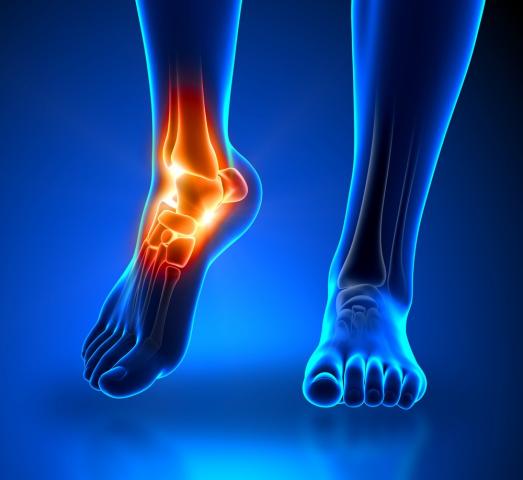 Rental and Sales of foot & Ankle injury products Port Alberni Vancouver Island