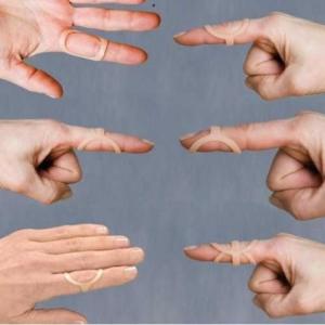 Oval-8 Splints are strong and nearly invisible splints designed to stabilize and align the DIP or PIP joint to enhance hand function. Molded from 1/16" (1.6mm) translucent plastic without seams. Can be used to correct lateral deviation, swan-neck deformity and flexible boutonniere deformity, support mallet finger injury, and help prevent trigger finger. Call The Comfort Zone Mobility Aids & Spas for Pricing 250 724 4477 or email info@albernicomfortzone.com